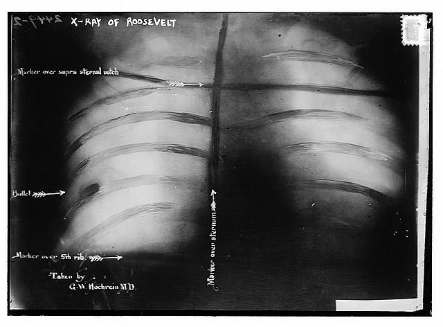 Roosevelt X-Ray